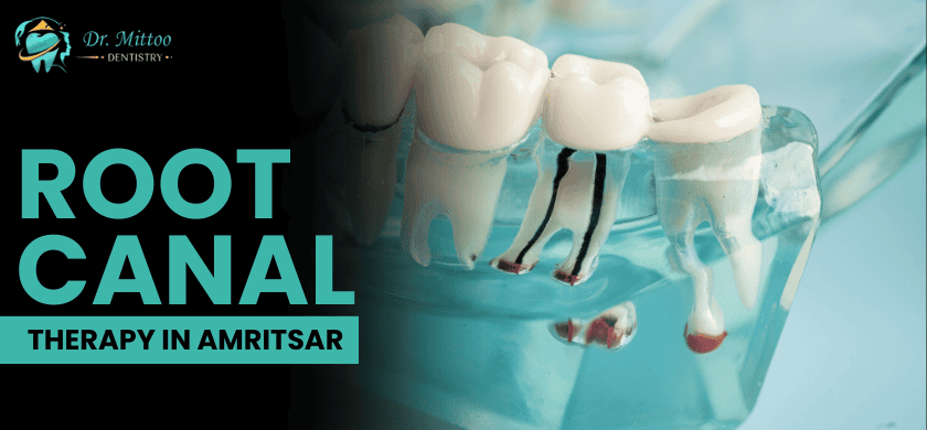 Aquacleaning ( contactless cleaning)